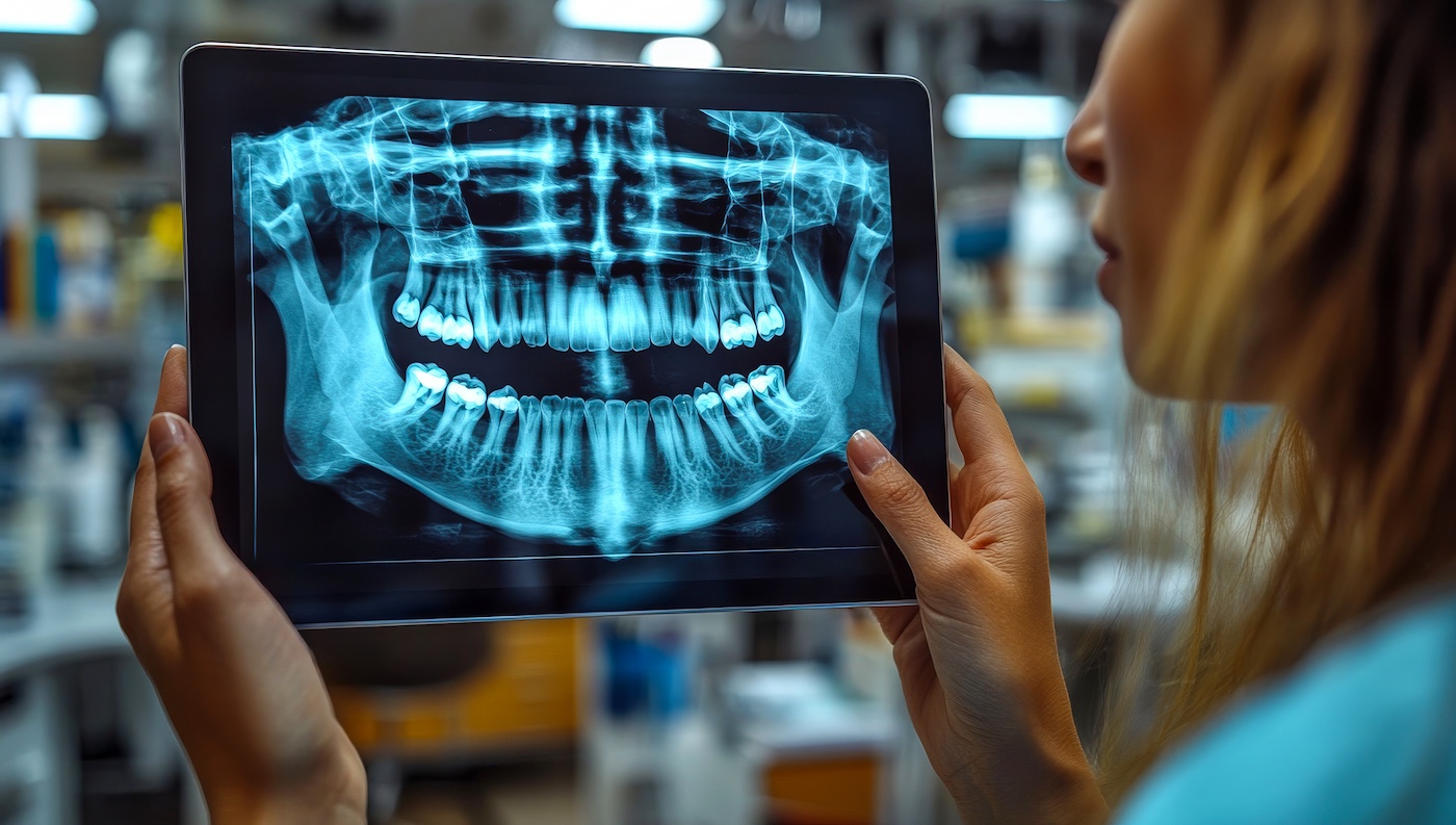 Dental X-rays offered at Smiles Dental, P.C. in Norfolk, NE