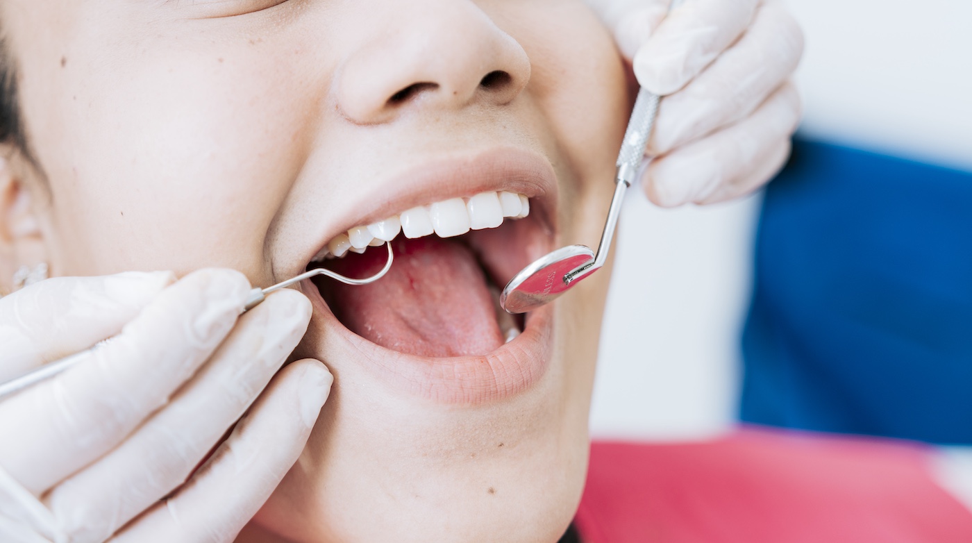 Periodontics treatment at Smiles Dental, P.C. in Norfolk, NE